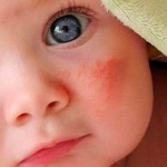 Инструкция по применению укропной водички для новорожденных и грудничков и как правильно ее приготовить в домашних условиях Инструкция по применению укропной водички для новорожденных и грудничков и как правильно ее приготовить в домашних условиях