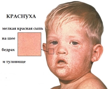 Как удалить и что это 4 Как удалить и что это 12