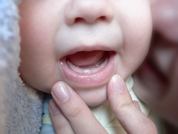 У ребенка режутся зубы